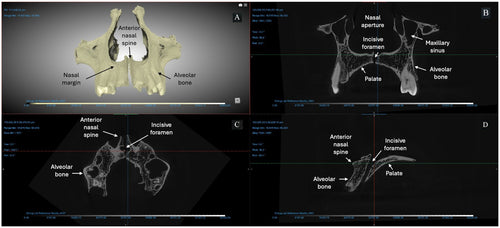 Ancient News: The Spread of Leprosy in the Bronze Age - Karwansaray Publishers
